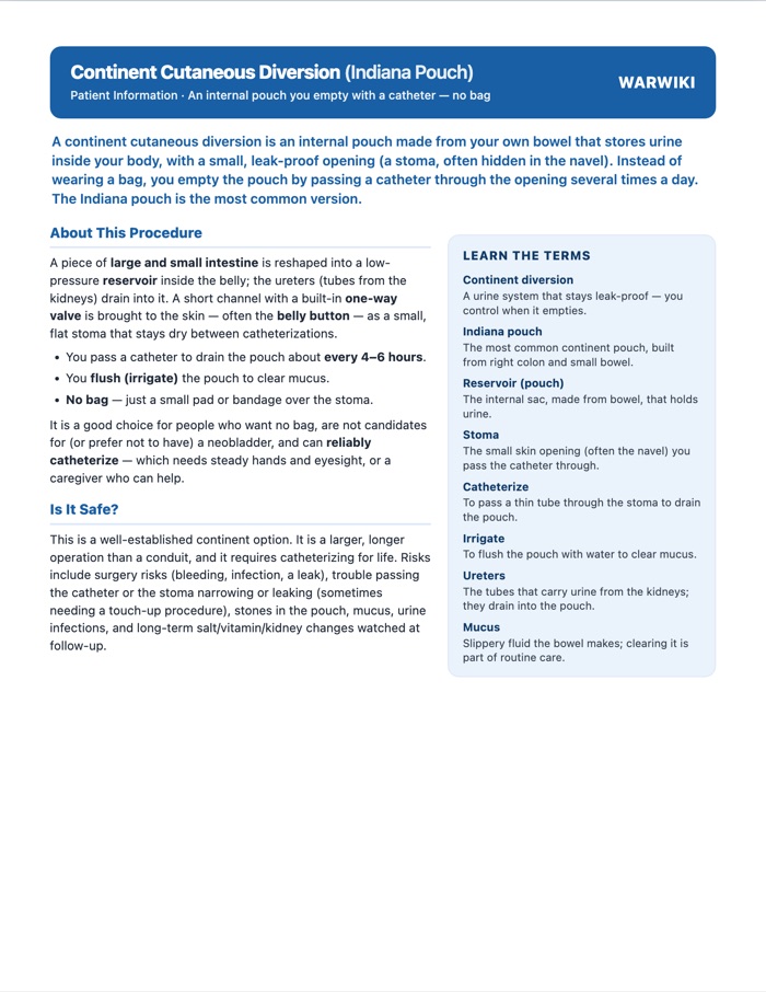 Continent Cutaneous Diversion (Indiana Pouch) — patient handout, page 1